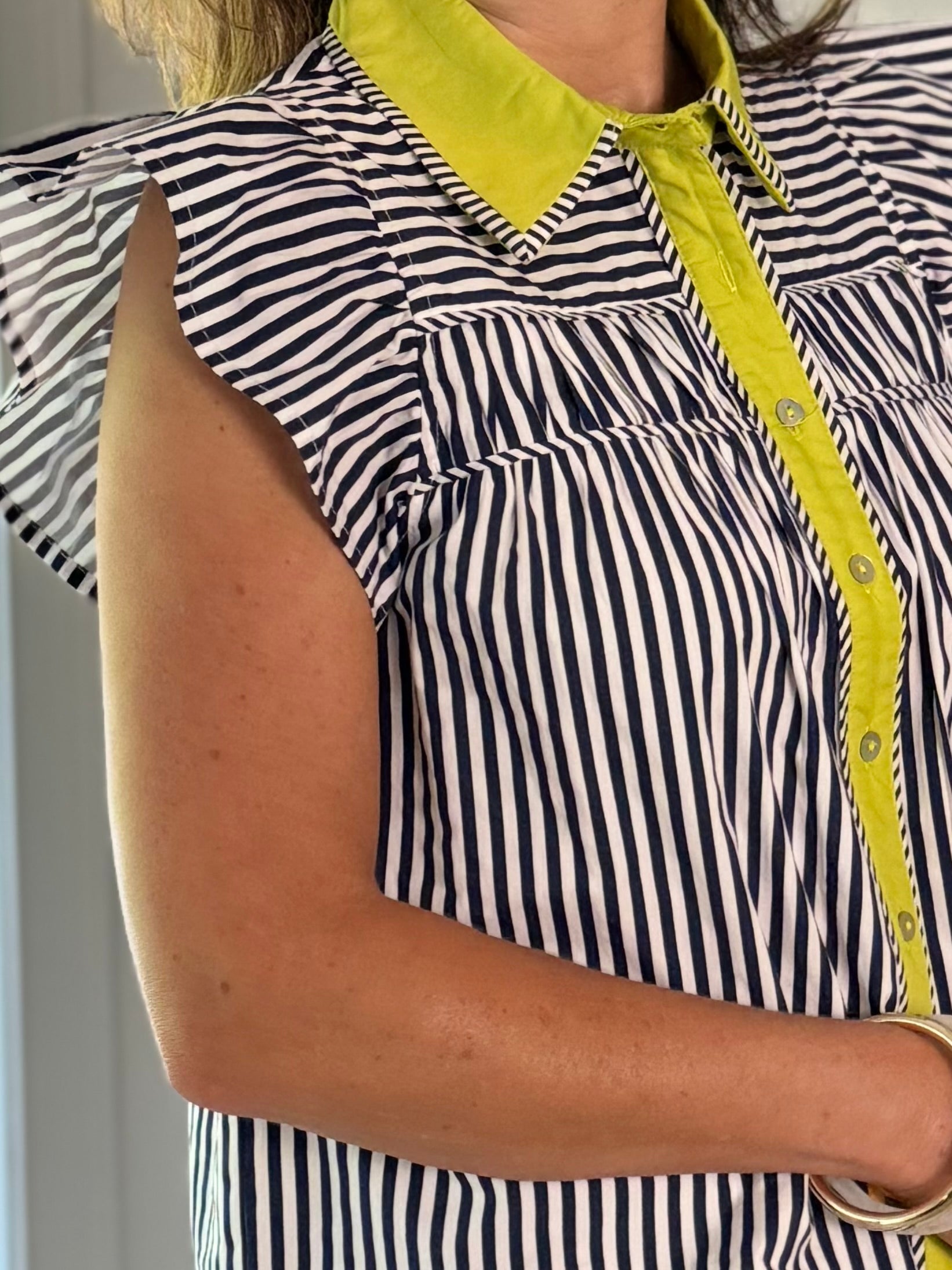 Standout Details Striped Top